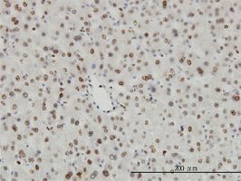 HDAC1 antibody (ab55094) used in immunohistochemistry at 3ug/ml on formalin fixed and paraffin embedded human liver.