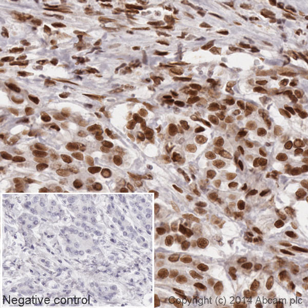 IHC image of HDAC1 staining in a section of formalin-fixed paraffin-embedded normal human pancreas*. The section was pre-treated using pressure cooker heat mediated antigen retrieval with sodium citrate buffer (pH6) for 30 mins. The section was incubated with ab193096 at a working dilution of 1 in 500 overnight at +4°C. The section was counterstained with haematoxylin and mounted with DPX.The inset negative control image is taken from an identical assay without primary antibody.For other IHC staining systems (automated and non-automated) customers should optimize variable parameters such as antigen retrieval conditions, primary antibody concentration and antibody incubation times.*Tissue obtained from the Human Research Tissue Bank, supported by the NIHR Cambridge Biomedical Research Centre
