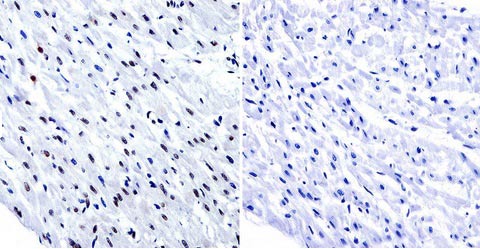 Immunohistochemical analysis of paraffin-embedded Human heart tissue labeling HDAC1 with ab184651 at 1/200 dilution. Tissues were incubated with primary antibody (left) or without primary antibody (negative control, right) overnight at 4°C. Detection was performed using a biotin-conjugated secondary antibody and SA-HRP, followed by colorimetric detection using DAB. Tissues were counterstained with hematoxylin.