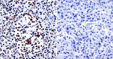 Immunohistochemical analysis of paraffin-embedded Human pancreas tissue labeling HDAC1 with ab184651 at 1/200 dilution. Tissues were incubated with primary antibody (left) or without primary antibody (negative control, right) overnight at 4°C. Detection was performed using a biotin-conjugated secondary antibody and SA-HRP, followed by colorimetric detection using DAB. Tissues were counterstained with hematoxylin.