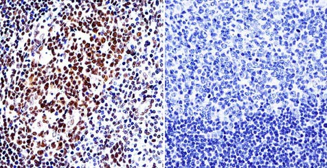 Immunohistochemical analysis of paraffin-embedded Human tonsil tissue labeling HDAC1 with ab184651 at 1/200 dilution. Tissues were incubated with primary antibody (left) or without primary antibody (negative control, right) overnight at 4°C. Detection was performed using a biotin-conjugated secondary antibody and SA-HRP, followed by colorimetric detection using DAB. Tissues were counterstained with hematoxylin.