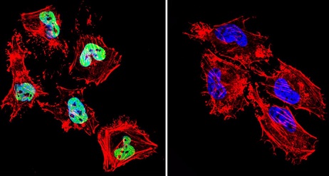 Immunofluroescent analysis of formaldehyde-fixed HeLa cells labeling HDAC1 with ab184651 at 1/20 dilution (green). Cells were incubated with primary antibody (left) or without (negative control, right) overnight at 4°C and incubated with a DyLight®488 conjugated secondary antibody. Nuclei were stained with DAPI (blue) and F-Actin with Phalloidin (red).