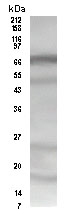 ab3964 at a 1:250 dilution staining approximately 70 kDa HDAC 10 in HeLa whole cell lysate by Western blot (ECL).