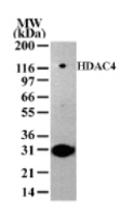 HDAC4 detection by Western blot. The analysis of HDAC4 in 293 cell extract with anti-HDAC4 pAb. A protein band of approximate molecular weight of 140 kDa was detected.