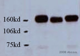 All lanes : Anti-HDAC6 antibody (ab12173) at 1/500 dilutionLane 1 : Whole cell lysate prepared from Human HepG2 cell line.Lane 2 : Whole cell lysate prepared from Human HepG2 cell line.Lane 3 : Whole cell lysate prepared from Human HepG2 cell line.Lysates/proteins at 20 µg per lane.SecondaryHRP conjugated goat anti-rabbit IgG at 1/2000 dilutiondeveloped using the ECL techniquePerformed under reducing conditions.Observed band size : 150 kDa (why is the actual band size different from the predicted?)Exposure time :  1 minuteThis image is courtesy of an Abreview submitted by Cheng SongSee Abreview