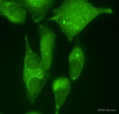 ab12173 staining mouse NIH3T3 cells by ICC/IF. Cells were formaldehyde fixed and permeabilized in 0.2% Triton X-100 prior to blocking in 10% serum for 1 hour at 25°C . The primary antibody was diluted 1/50 and incubated with sample for 1 hour at 25°C . A Alexa Fluor® 488 goat polyclonal to rabbit IgG was used as the secondary, diluted 1/200.See Abreview