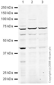 All lanes : Anti-HDAC8 antibody (ab23658) at 1 µg/mlLane 1 : HeLa Whole Cell LysateLane 2 : Jurkat (Human T cell lymphoblast-like cell line) Whole Cell Lysate (ab7899)Lane 3 : A431 (Human epithelial carcinoma cell line) Whole Cell Lysate (ab7909)Lysates/proteins at 20 µg per lane.SecondaryGoat polyclonal to Rabbit IgG H&L (HRP) Pre-Adsorbed at 1/10000 dilutionPerformed under reducing conditions.