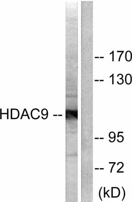 All lanes : Anti-HDAC9 antibody (ab53102) at 1/300 dilutionLane 1 : HepG2 cell extractLane 2 : HepG2 cell extract with peptide