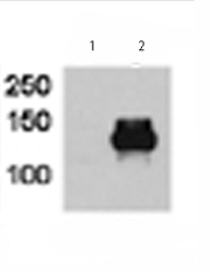 All lanes : Anti-HDAC9 antibody (ab70954) at 1/100 dilutionLane 1 : Non-transfected Hela cellsLane 2 : HDAC9 transfected Hela cells
