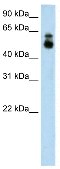 Anti-HDAC9 antibody - ChIP Grade (ab59718) at 1.25 µg/ml + A172 cell lysate at 10 µgSecondaryHRP conjugated anti-Rabbit IgG used at 1/50000