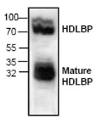 Anti-HDLBP antibody (ab70813) at 4 µg/ml + Rat kidney tissue lysate