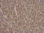 ab126252, at 1/500, staining Heat Shock Factor 2 Binding Protein in Human U87 xenograft by immunohistochemistry [Paraffin Embedded Tissues (IHC-P).