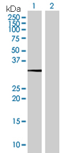 All lanes : Anti-Heat Shock Factor 2 Binding Protein antibody (ab168925) at 1/500 dilutionLane 1 : Heat Shock Factor 2 Binding Protein-transfected 293T cell lysateLane 2 : Non-transfected 293T cell lysateLysates/proteins at 15 µl per lane.SecondaryGoat Anti-Mouse IgG (H&L)-HRP at 1/2500 dilutiondeveloped using the ECL technique