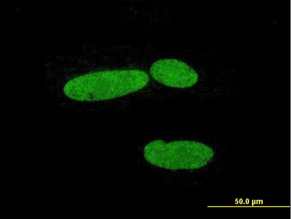 Immunofluorescent analysis of Hs 181.Tes cells, labeling Heat Shock Factor 2 Binding Protein with purified ab168925 at 10 µg/ml. Antibody purification with Protein A will be needed prior to use.