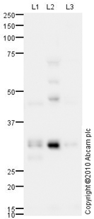 All lanes : Anti-Heme Oxygenase 1 antibody (ab85309) at 1 µg/mlLane 1 : Spleen (Rat) Tissue Lysate Lane 2 : Heart (Rat) Tissue Lysate Lane 3 : Lung (Rat) Tissue Lysate Lysates/proteins at 10 µg per lane.SecondaryGoat polyclonal to Rabbit IgG - H&L - Pre-Adsorbed (HRP) at 1/3000 dilutiondeveloped using the ECL techniquePerformed under reducing conditions.