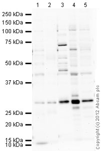 All lanes : Anti-Heme Oxygenase 1 antibody (ab85309) at 1 µg/mlLane 1 : Spleen (Human) Tissue Lysate - adult normal tissue (ab29699)Lane 2 : Lung (Human) Whole Cell Lysate - adult normal tissue (ab30281)Lane 3 : Heart (Mouse) Tissue Lysate Lane 4 : Spleen (Mouse) Tissue LysateLane 5 : Lung (Mouse) Whole Cell Lysate - normal tissue (ab29297)Lysates/proteins at 10 µg per lane.SecondaryGoat Anti-Rabbit IgG H&L (HRP) preadsorbed (ab97080) at 1/5000 dilutiondeveloped using the ECL techniquePerformed under reducing conditions.