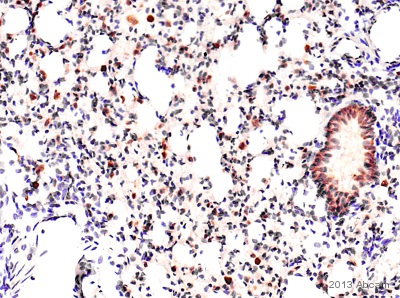 Immunohistochemistical detection of Anti-Heme Oxygenase 1 antibody (ab85309; 1/5000 for 2h @ 21°C)on rat lung formalin/PFA-fixed paraffin-embedded sections. Antigen retrieval step:Heat mediated - Buffer/Enzyme Used: Citric acid.Blocking step: 1% BSA for 10 mins. Secondary antibody biotin conjugated anti Rabbit IgG (1/200). NB: As well as in macrophage cytoplasm, there is also clear positivity in the lining epitheium of the respiratory conducting tubes. I do not know if this is specific/non-specific.