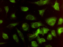 Heme oxygenase 2 antibody (ab55174) used in immunofluorescence at 1-5ug/ml on HeLa cells.