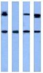Lane 1 :  Anti-Heme oxygenase 2 antibody (ab22752) at 1 µg/ml (Jurkat cell lysate)Lane 2 :  Anti-Heme oxygenase 2 antibody (ab22752) at 1 µg/ml (HepG2 cell lysate)Lane 3 :  Anti-Heme oxygenase 2 antibody (ab22752) at 1 µg/ml (Raji cell lysate)Lane 4 :  Anti-Heme oxygenase 2 antibody (ab22752) at 1 µg/ml (293T cell lysate)Lane 1 : As aboveLane 2 : As aboveLane 3 : As aboveLane 4 : As abovePerformed under reducing conditions.