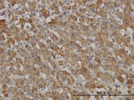 Hepcidin-25 antibody (ab57611) used in immunohistochemistry at 3ug/ml on formalin fixed and paraffin embedded human liver.
