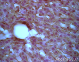 Hepcidin-25 expression in Rat liver cells using Rabbit polyclonal to Hepcidin-25 (ab30760).Immunohistochemistry was performed on PFA fixed cells, ab30760 was used at 1/1000 incubated overnight at RT. Haemotoxylin is used as a nuclear counterstain in this image.