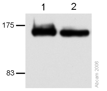 All lanes : Anti-CTCF antibody [mAbcam 37477] (ab37477) at 2 µg/mlLane 1 : ZR-75-1 cell extractLane 2 : HCT-116 cell extract