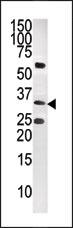 Anti-CTDSP1 antibody - C-terminal (ab76099) at 1/100 dilution + CEM tissue lysate at 12.5 µg