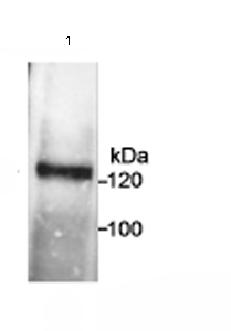 Immunoprecipitation/ Western Blot of Ctip1. Lane 1: ab72247 at 1µg/0.5mg lysate for IP. ab72247 at 0.5µg/ml for WB. Nuclear lysate from Raji cells at 0.5mg for IP. Detection:Chemiluminescence with an exposure time of 5 minutes.
