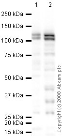 All lanes : Anti-Ctip2 antibody (ab28448) at 1 µg/mlLane 1 : Jurkat (Human T cell lymphoblast-like cell line) Whole Cell LysateLane 2 : Jurkat (Human T cell lymphoblast-like cell line) Nuclear Lysate (ab14844)Lysates/proteins at 10 µg per lane.SecondaryGoat polyclonal to Rabbit IgG - H&L - Pre-Adsorbed (HRP) at 1/3000 dilutionPerformed under reducing conditions.