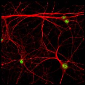 Neonatal Mouse Hippocampal Neurons (Harvested at P1, grown 5d in culture on glial cell feeder layer).Red is beta tubulin staining.Green is ab18465.