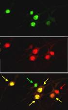 Neonatal mouse hippocampal neurons stained with ab18465 (top panel - green) and Ctip1 antibody (middle - red). Bottom panel is overlay of ab18465 and Ctip1 antibody staining - yellow indicates co-localisation, green is ab18465 alone and red is Ctip1 antibody alone.