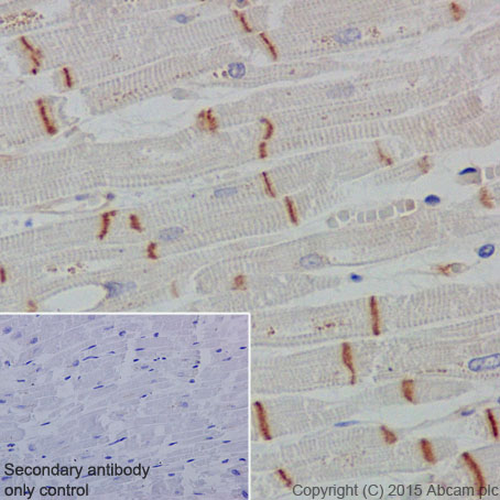 Immunohistochemical analysis of paraffin-embedded Human cardiac muscle tissue labeling CTNNA3 with ab184916 at 1/2000 dilution, followed by Goat Anti-Rabbit IgG H&L (HRP) (ab97051) secondary antibody at 1/500 dilution. Intercalated disks staining of normal Human cardiac muscle is observed. Counter stained with Hematoxylin.Secondary antibody only control: Used PBS instead of primary antibody, secondary antibody is Goat Anti-Rabbit IgG H&L (HRP) (ab97051) at 1/500 dilution.