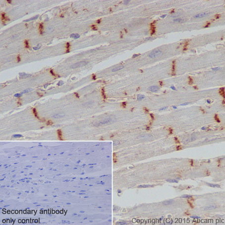 Immunohistochemical analysis of paraffin-embedded Mouse cardiac muscle tissue labeling CTNNA3 with ab184916 at 1/2000 dilution, followed by Goat Anti-Rabbit IgG H&L (HRP) (ab97051) secondary antibody at 1/500 dilution. Intercalated disks staining on Mouse cardiac muscle is observed. Counter stained with Hematoxylin.Secondary antibody only control: Used PBS instead of primary antibody, secondary antibody is Goat Anti-Rabbit IgG H&L (HRP) (ab97051) at 1/500 dilution.