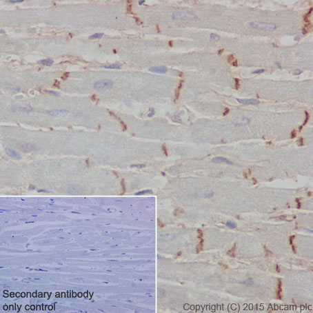 Immunohistochemical analysis of paraffin-embedded Rat cardiac muscle tissue labeling CTNNA3 with ab184916 at 1/2000 dilution, followed by Goat Anti-Rabbit IgG H&L (HRP) (ab97051) secondary antibody at 1/500 dilution. Intercalated disks staining on Rat cardiac muscle is observed. Counter stained with Hematoxylin.Secondary antibody only control: Used PBS instead of primary antibody, secondary antibody is Goat Anti-Rabbit IgG H&L (HRP) (ab97051) at 1/500 dilution.