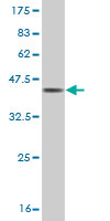 Western blot against tagged recombinant protein immunogen using ab57875 CTNNAL1 antibody at 1ug/ml.