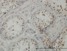 CTNNBL1 antibody (ab57617) used in immunohistochemistry at 3ug/ml on formalin fixed and paraffin embedded human testis.