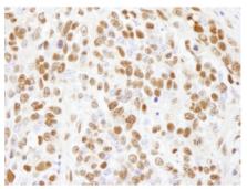 ab 84487 at 1/250 dilution staining formalin-fixed, paraffin-embedded section of mouse teratoma by immunohistochemistry. Detection: DAB staining