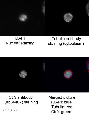 ab84487 staining CTR9 in Mouse ES cells by ICC/IF (Immunocytochemistry/immunofluorescence). Cells were fixed with methanol and blocked with 0.2% serum for 1 hour at 25°C. Samples were incubated with primary antibody (1/250 PBS + 0.2% fish scale gelatin in PBS) for 20 minutes at 25°C. An Alexa Fluor®488-conjugated Donkey anti-rabbit IgG polyclonal (1/500) was used as the secondary antibody. See Abreview