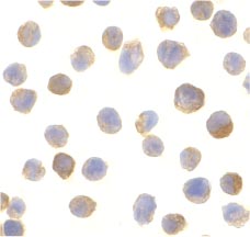 ab25943 at 10µg/ml staining CTRP2 in Jurkat cells by ICC/IF
