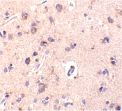 ab25944 at 10µg/ml staining CTRP2 in human brain tissue by IHC