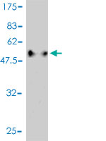 Western blot against tagged recombinant protein immunogen using ab57967 CTRP2 antibody at 1ug/ml.