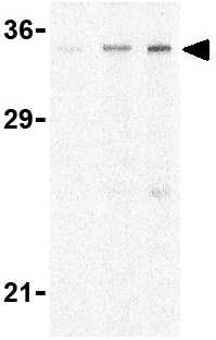 Lane 1 :  Anti-CTRP4 antibody (ab36891) at 1 µg/mlLane 2 :  Anti-CTRP4 antibody (ab36891) at 2 µg/mlLane 3 :  Anti-CTRP4 antibody (ab36891) at 4 µg/mlLane 1 : Rat brain cell lysateLane 2 : Rat brain cell lysateLane 3 : Rat brain cell lysateLysates/proteins at 15 µg/ml per lane.Secondaryanti-rabbit IgG HRP at 1/10000 dilution