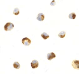 ab25947 at 0.5µg/ml staining CTRP7 in HL60 cells by ICC/IF