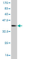 Western blot against tagged recombinant protein immunogen using ab56854 COG2 antibody at 1ug/ml.