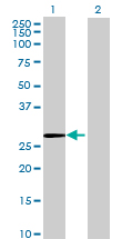 All lanes : Anti-CUTC antibody (ab68737) at 1/500 dilutionLane 1 : CUTC transfected 293T cell lysateLane 2 : Non transfected 293T cell lysateLysates/proteins at 25 µg per lane.SecondaryGoat Anti-Mouse IgG (H&L)-HRP conjugated at 1/2500 dilution
