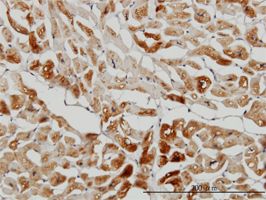 cvHSP antibody (ab57093) used in immunohistochemistry at 3ug/ml on formalin fixed and paraffin embedded human heart.