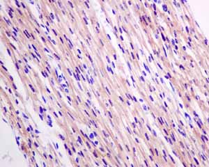 Immunohistochemical analysis of paraffin embedded Human Fetal heart tissue using ab150390 showing +ve staining.