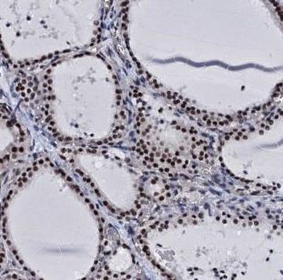 Immunohistochemical staining of Human thyroid gland labeling CWC15 using ab188345 at 1/500 dilution.