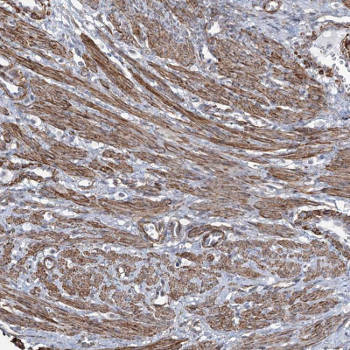 Immunohistochemical analysis of paraffin-embedded Human smooth muscle tissue labeling CWF19L1 with ab150842 at 1/500 dilution.