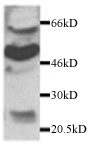 Western blot detection of CX3CR1 in the Brain by rabbit polyclonal to human CX3CR1 (V28).